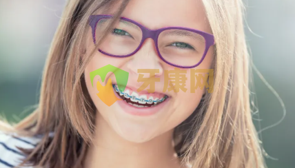 儿童牙齿不齐怎么矫正