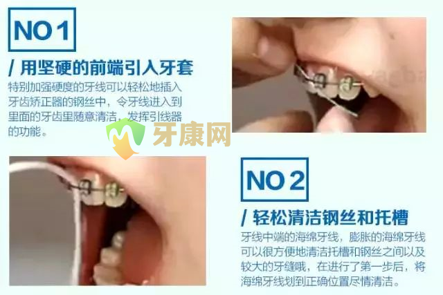 牙线的使用方法