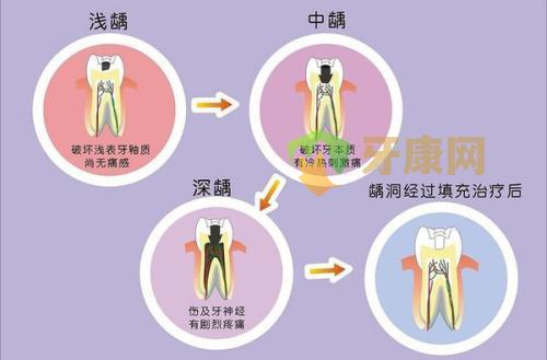 简单的牙齿保健