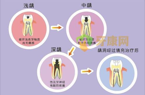 简单的牙齿保健