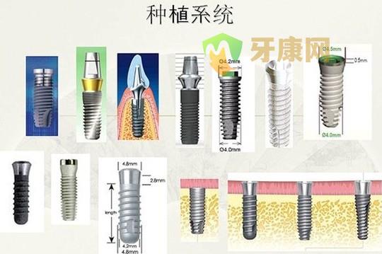 瑞士ITI种植系统