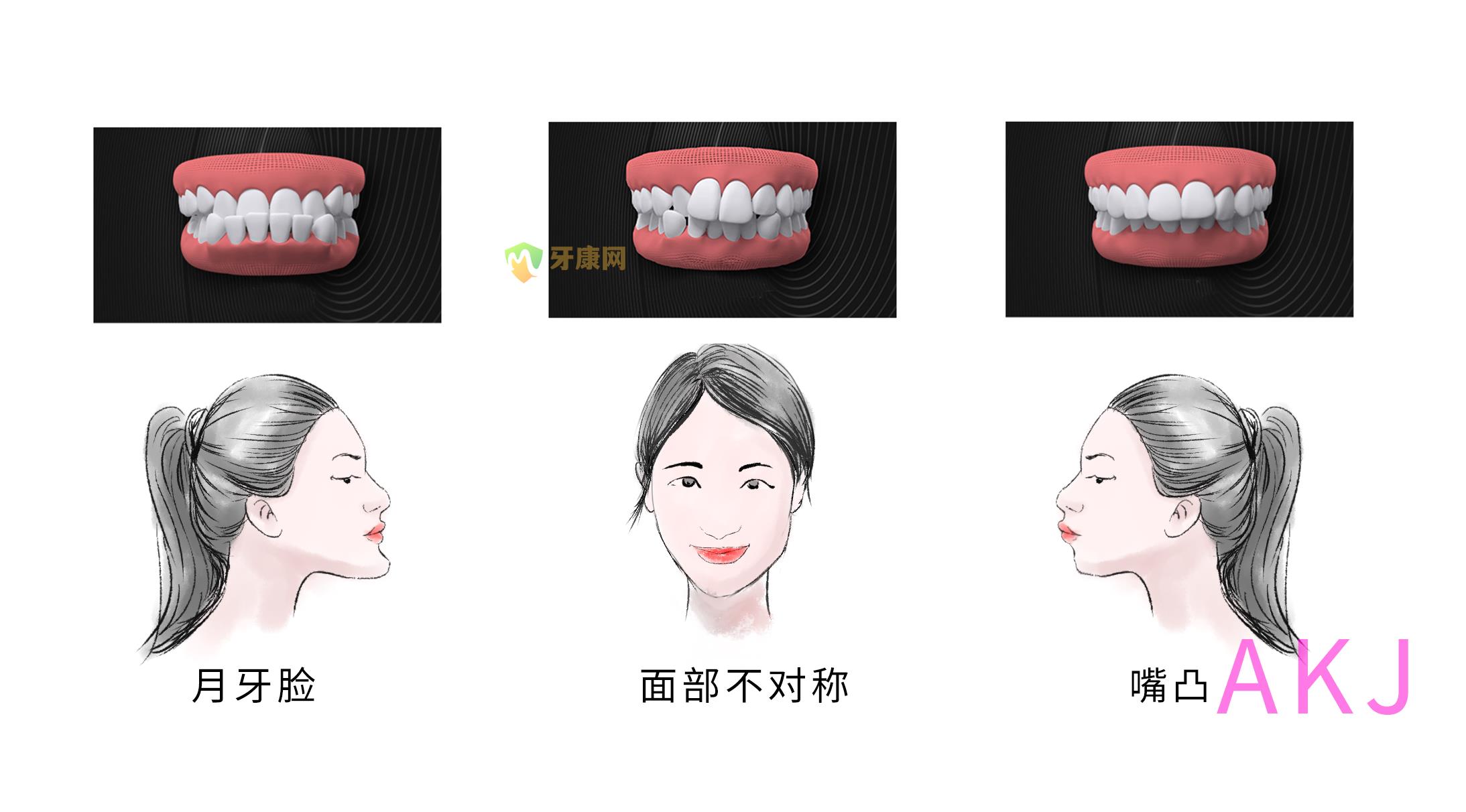 牙齿畸形