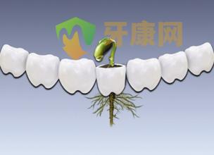 美国3I纳米种植牙系统适合哪些人