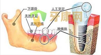 种植牙术前具体的检查项目有哪些？