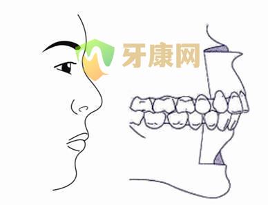  牙齿前突是怎么回事？