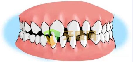 牙缝大是怎么造成的
