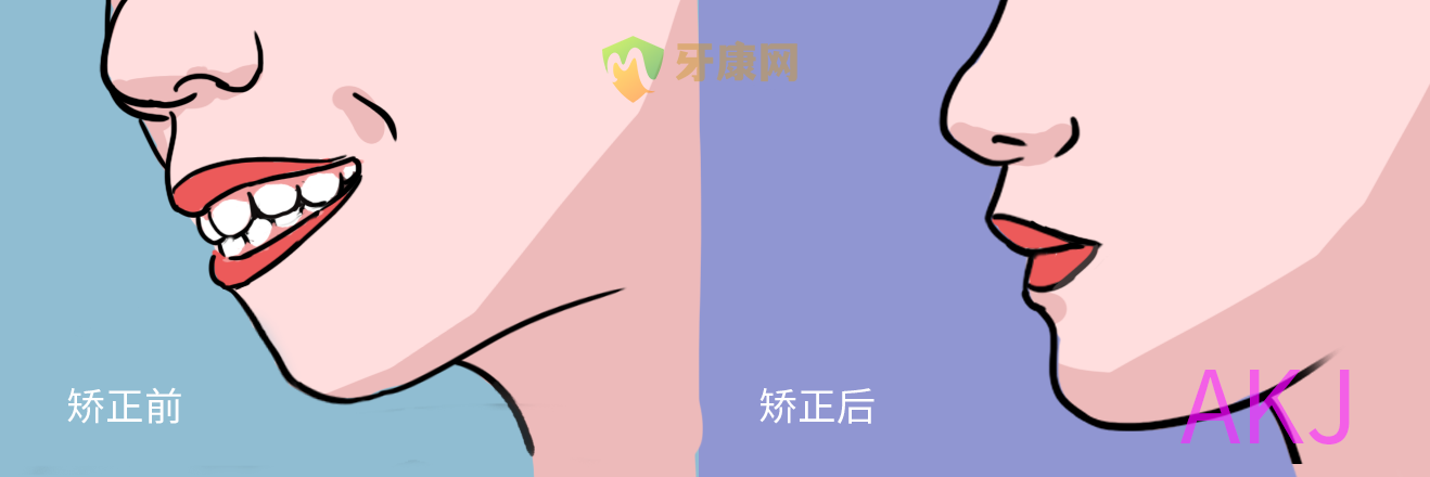 矫正