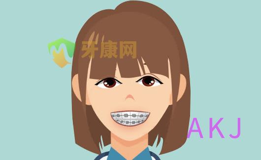 正畸