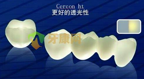 泽康（cercon）氧化锆全瓷牙