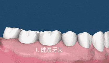 预防牙周病