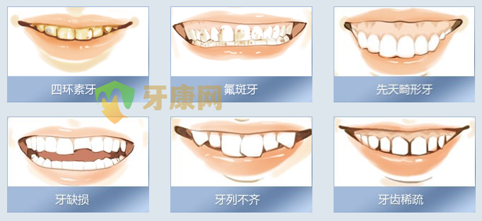 牙健网西诺德全瓷牙适用人群