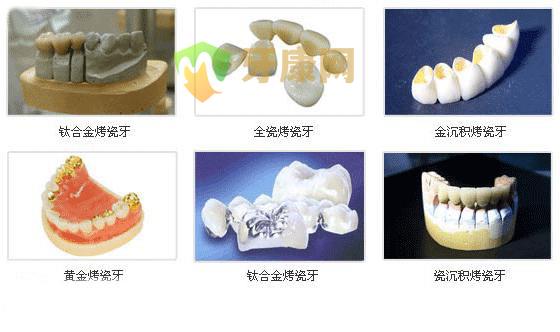 性价比高的烤瓷牙有哪些？