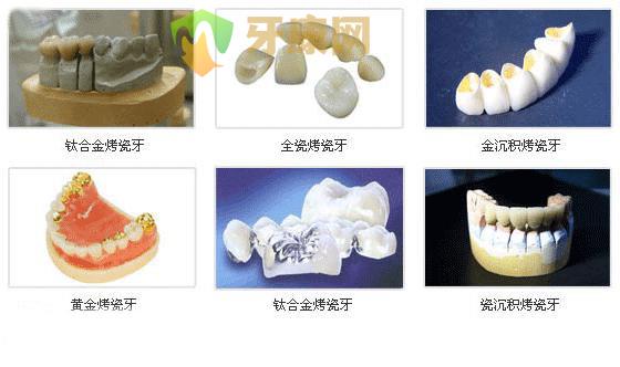 全瓷牙与贵金属烤瓷牙的区别有哪些？