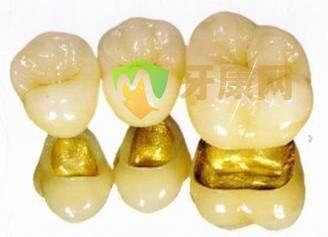 深圳哪家医院做烤瓷牙好