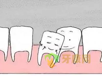 牙齿松动的原因