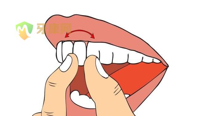 牙齿松动的治疗方法