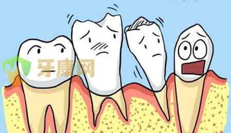 哪类人容易患牙周炎