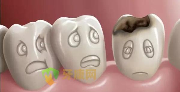 蛀牙很深为何还要保留烂牙根