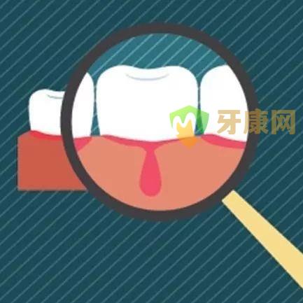 牙龈经常出血的六个原因
