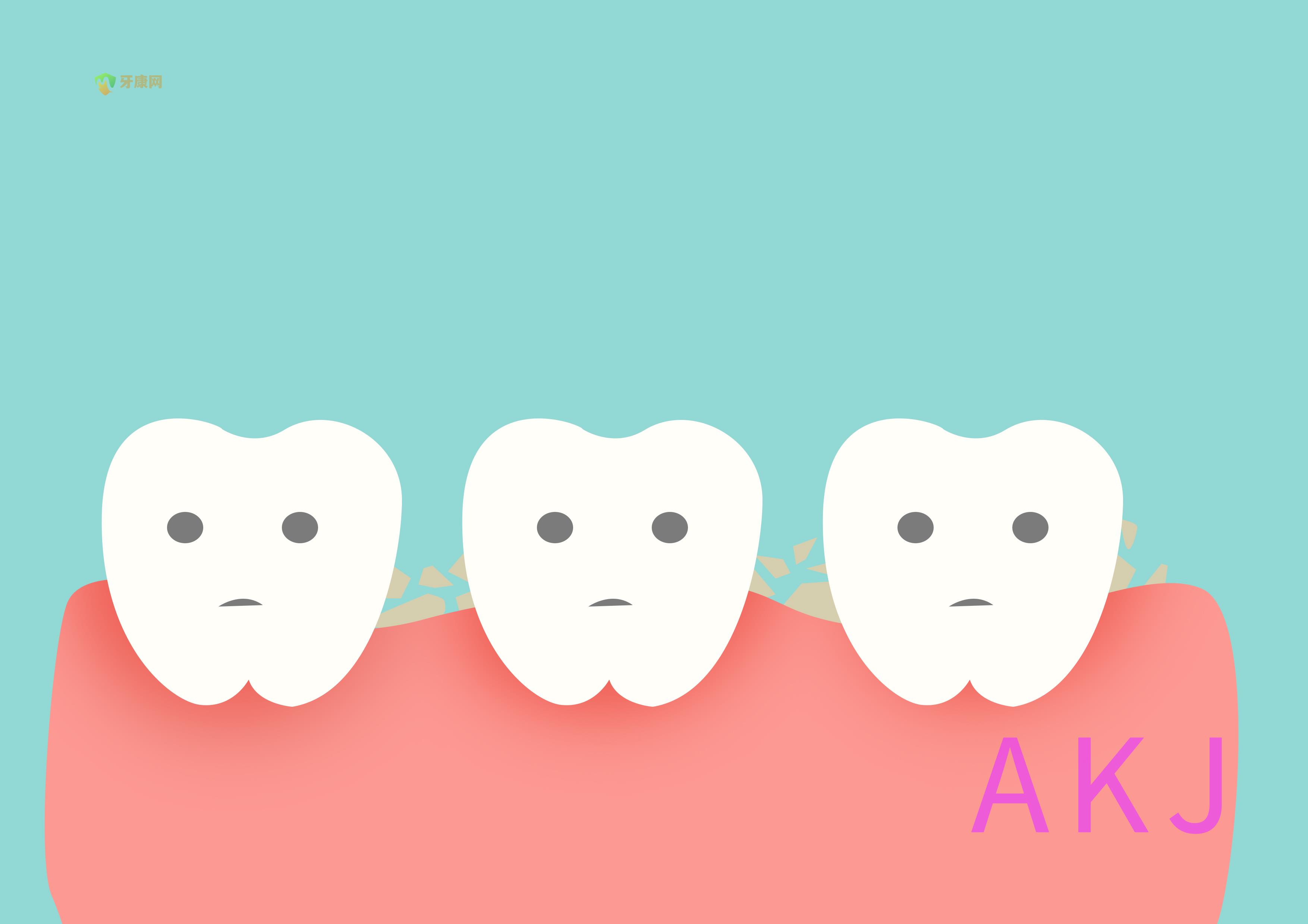 牙周炎，牙结石多，需要洗牙和治疗