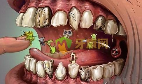 哪些原因会造成牙隐裂，牙隐裂怎么修复？