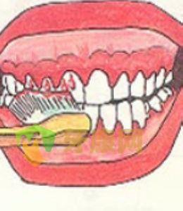哪些疾病会引起牙龈出血