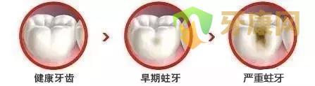 补牙