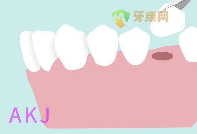 拔牙