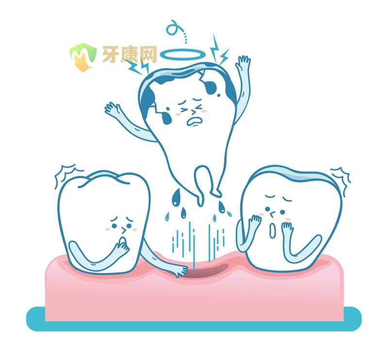 牙齿脱落
