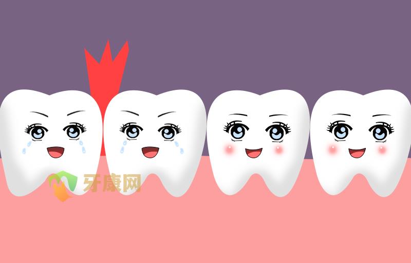牙龈炎