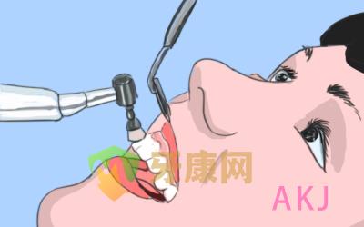 洁牙