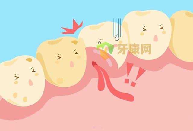 牙龈肿痛