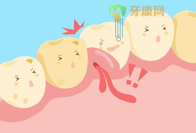 牙龈肿痛
