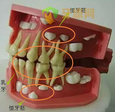 换牙时期示意图